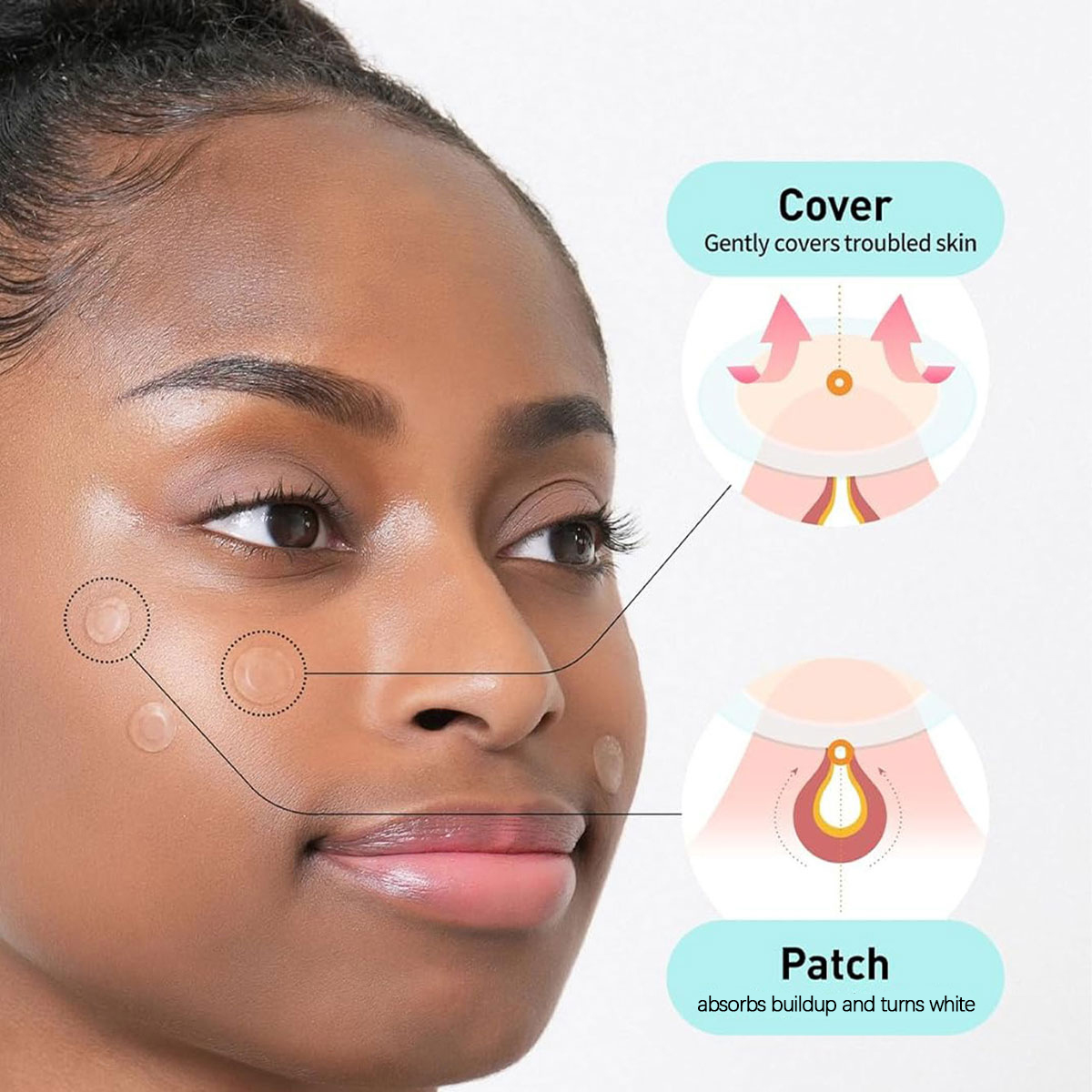 Olive Young Care Plus Spot Cov - Luxury Skincare Korea ulasan dan harga