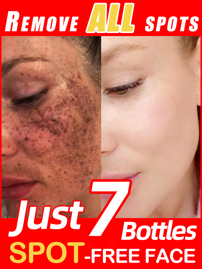 Mencerahkan Bintik-Bintik, Mel - Luxury Natural Skincare ulasan dan harga